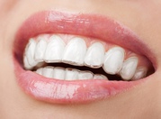 Smilelign - Get straighten teeth
